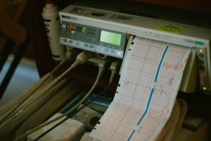 Photograph of a heart monitor with a paper printout of the results.