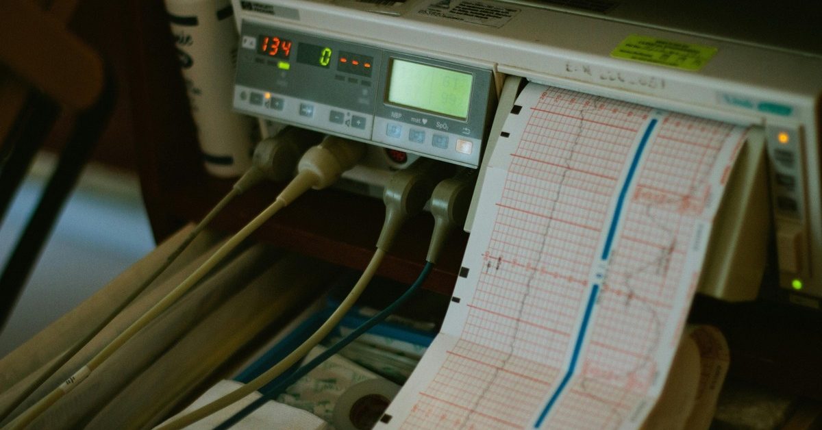 Photograph of a heart monitor with a paper printout of the results.